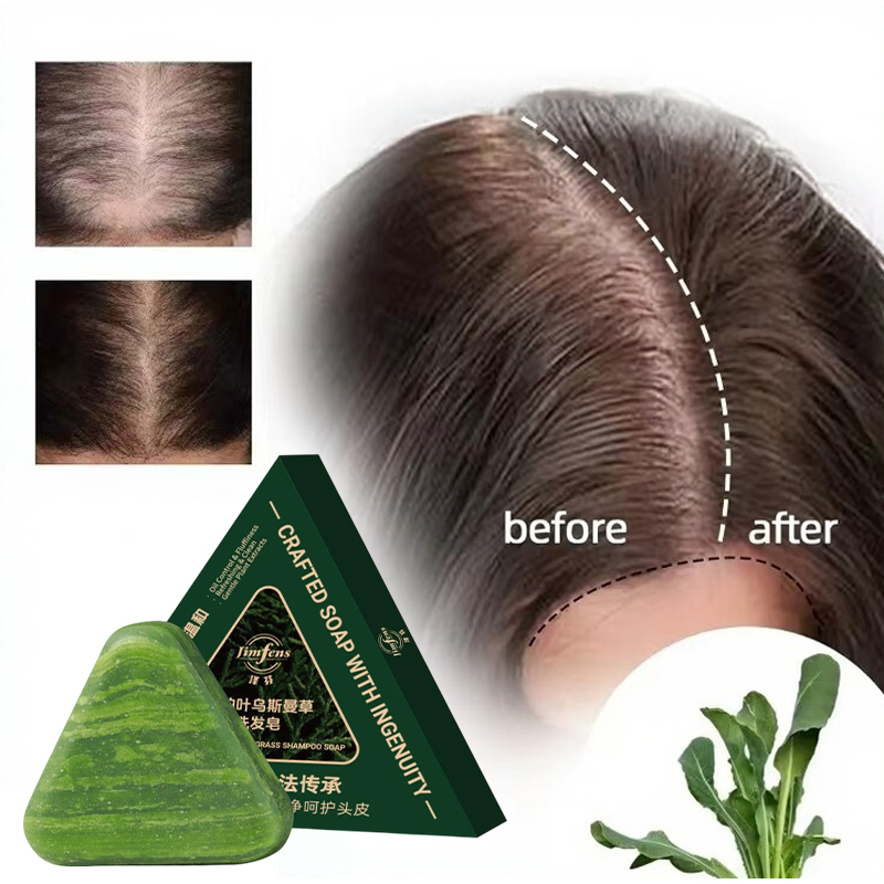 Anti-hair Loss Shampoo Bar! Wi – Bar Soap Shampoo Solid recenzja i cena